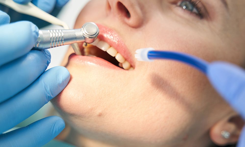 Primer plano de una mujer acostada en una silla dental mientras el dentista con guantes estériles hace tratamiento dental.
